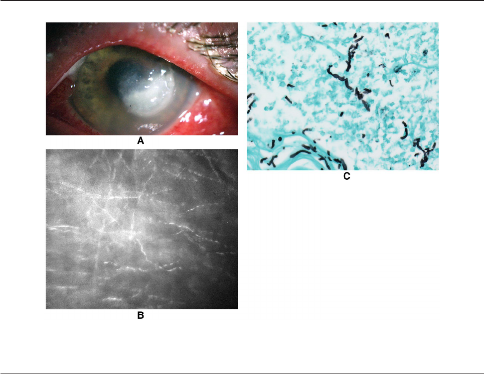 Ocular cytology: Diagnostic features and ongoing practices
