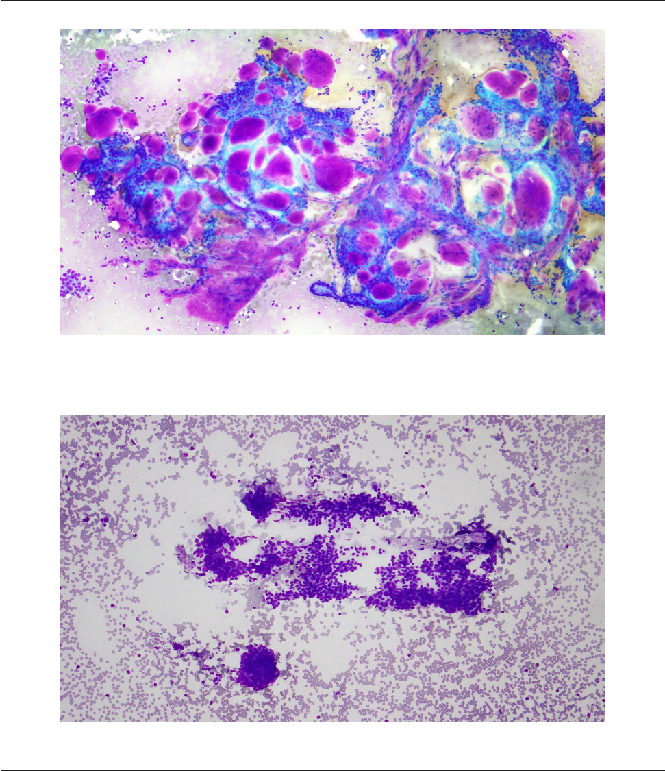 Putting morphology to the test: An established classification scheme reliably stratifies salivary gland cytology by risk of malignancy with substantial interobserver agreement